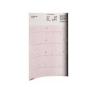 Mortara 230 EKG Chart Paper