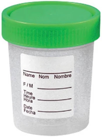 Urine Specimen Containers